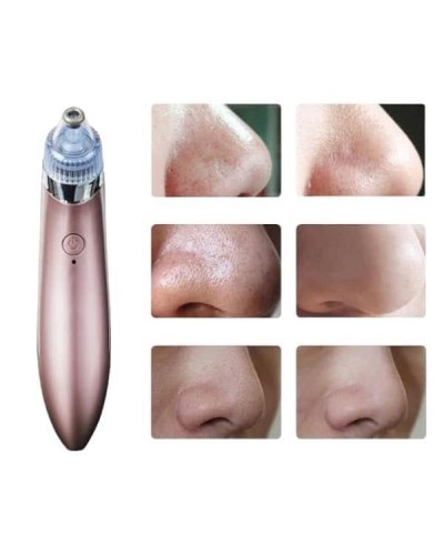 SİYAH NOKTA CİHAZI